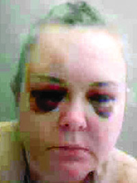 Jackie Dean was beaten in her cell last year, but waited days for medical treatment.