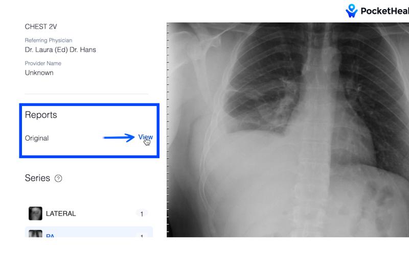 Digital interfaces like this for medical scans will be commonplace from now on for patients who get treated at Habersham Medical Center. POCKETHEALTH/Submitted