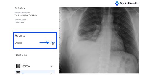 Digital interfaces like this for medical scans will be commonplace from now on for patients who get treated at Habersham Medical Center. POCKETHEALTH/Submitted